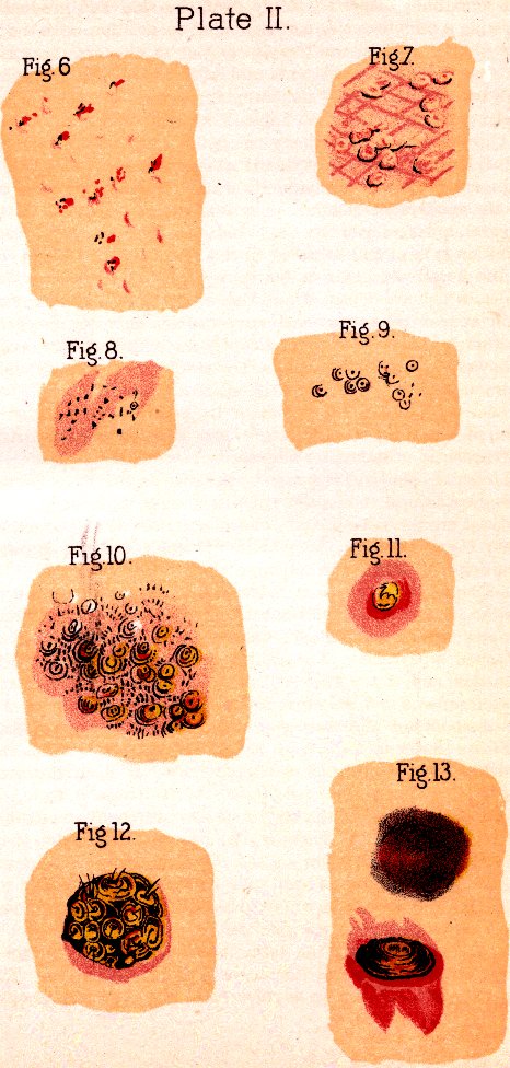 Illustration:
Plate II. Fig. 6. Fig. 7. Fig. 8. Fig. 9. Fig. 10. Fig. 11. Fig. 12. Fig.
13.