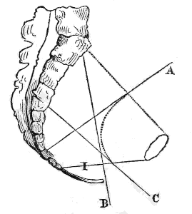 Passage
of the Pelvis